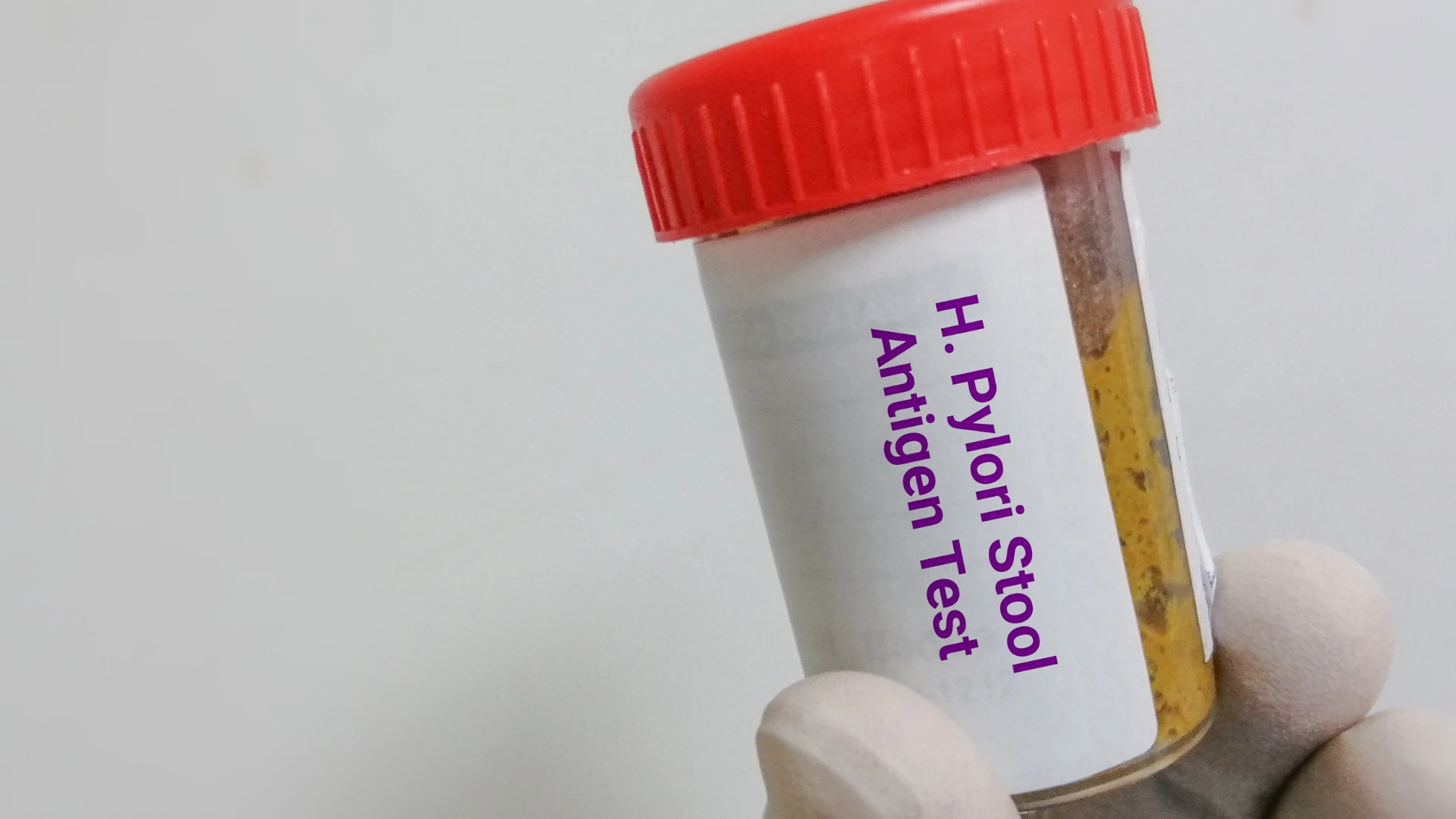 Helicobacter Pylori Antigen Stool Test